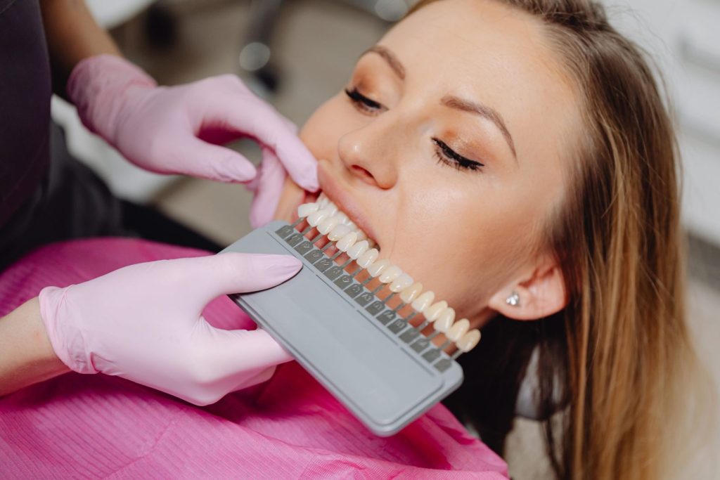Dental shade guide used during a teeth whitening procedure