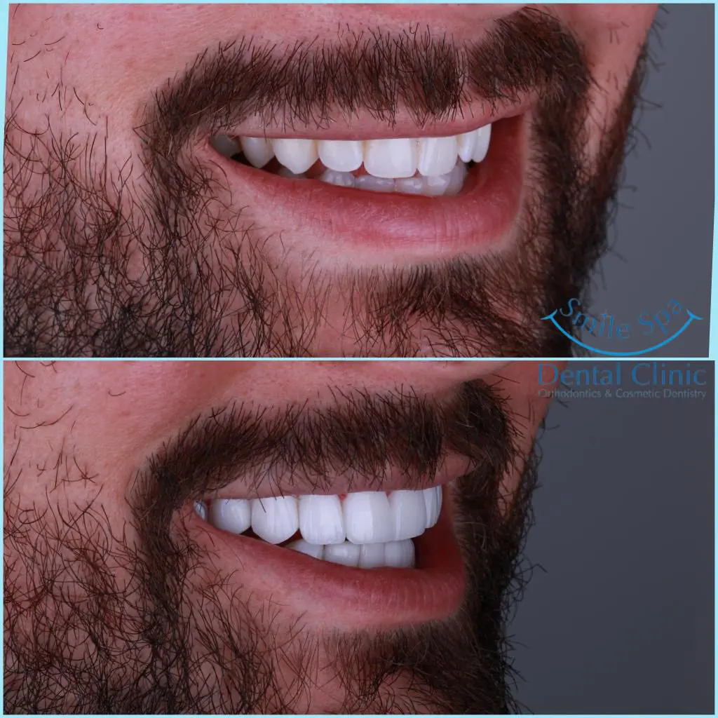 7 benefits of orthodontics