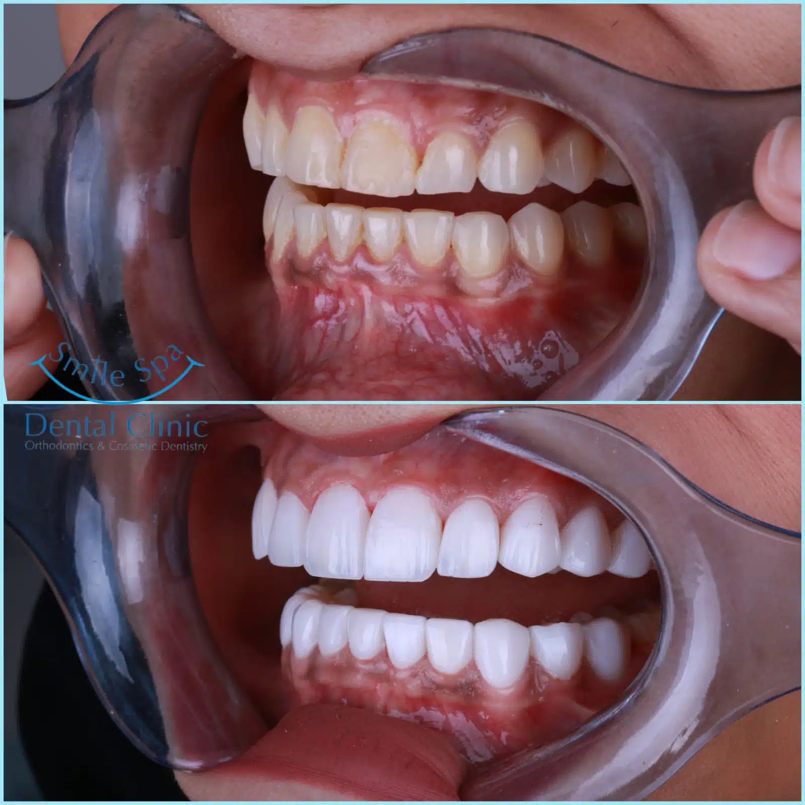 image2 - Copy
