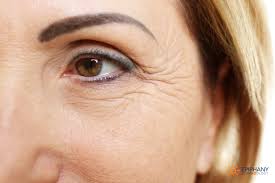 6 Ways to Treat Wrinkles