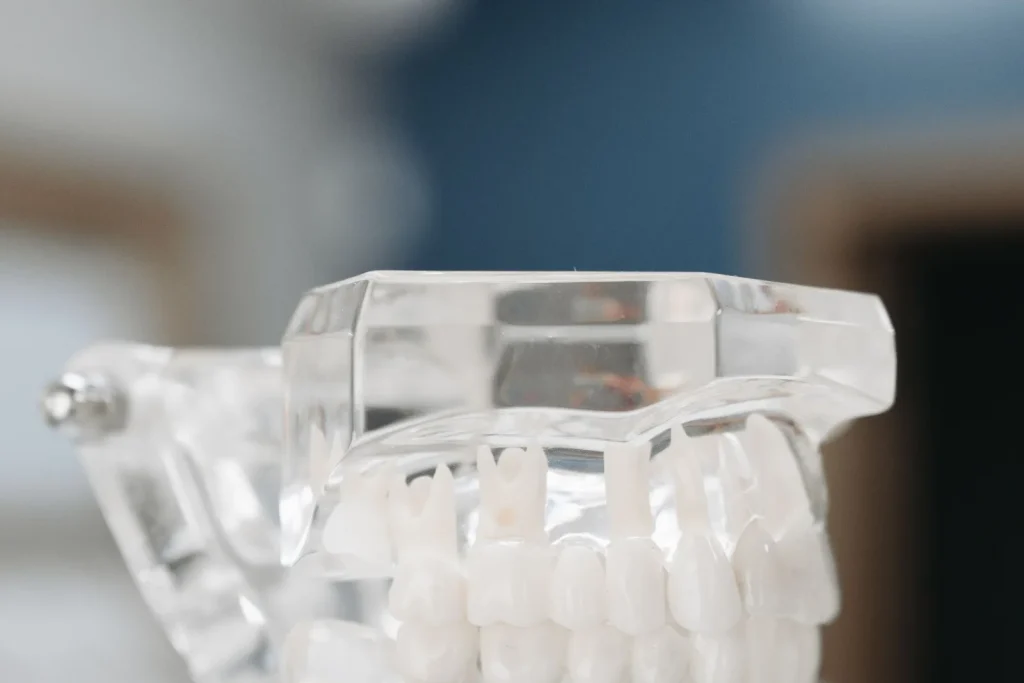 Transparent dental model showing implant screws