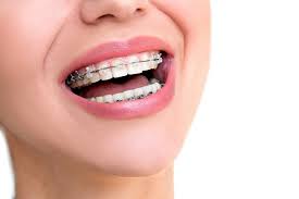 Benefits of orthodontics