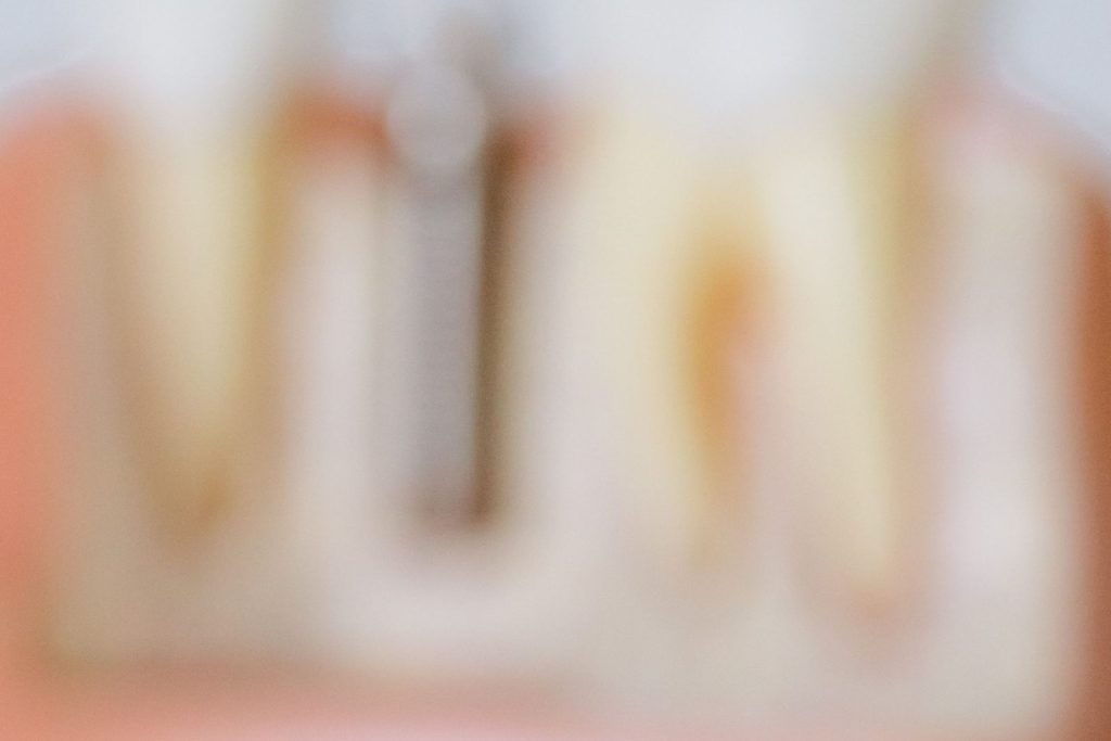 Close-up of a dental implant crown in a sterile clinic