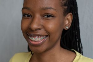 Smiling young woman with braces – orthodontics benefits