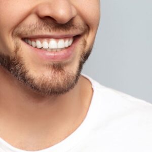 Composite Bonding