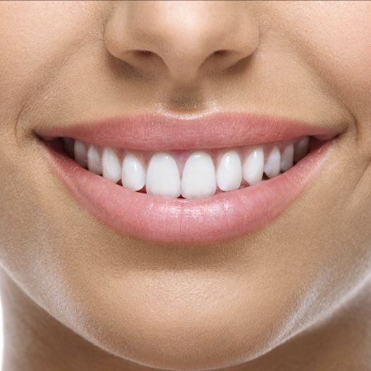Composite Bonding