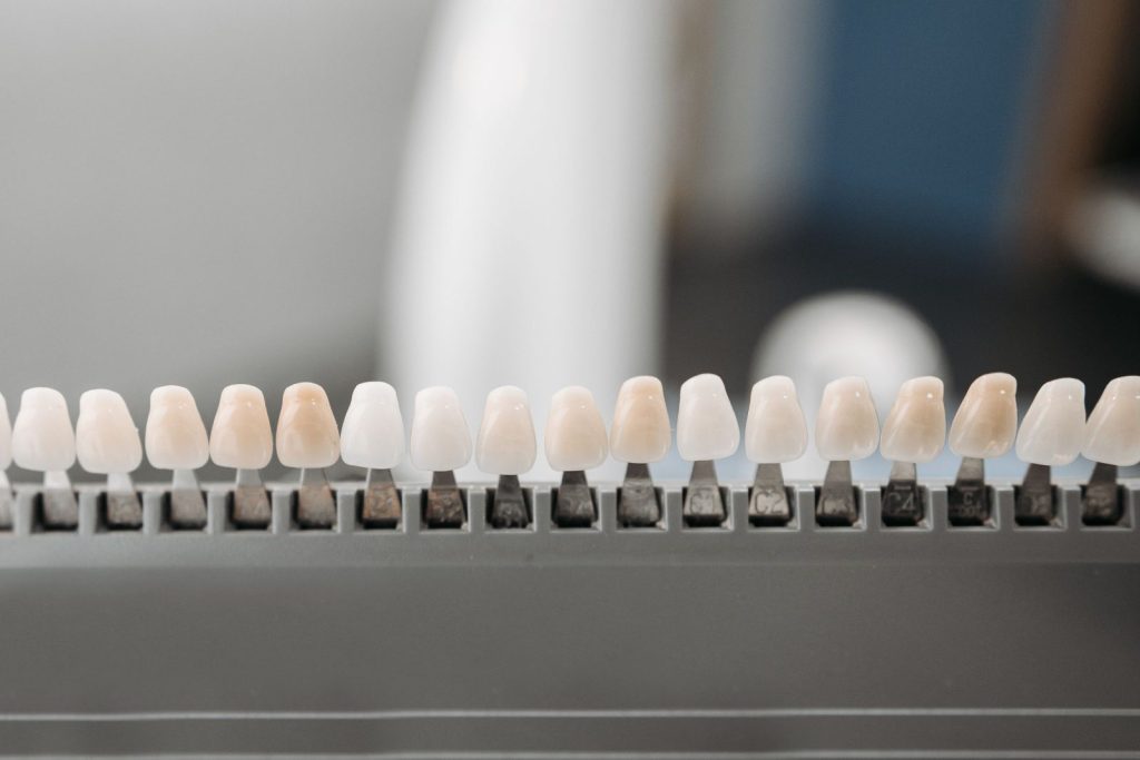 Porcelain veneers shade samples on a display rack