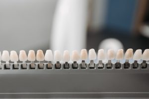 Porcelain veneers shade samples on a display rack