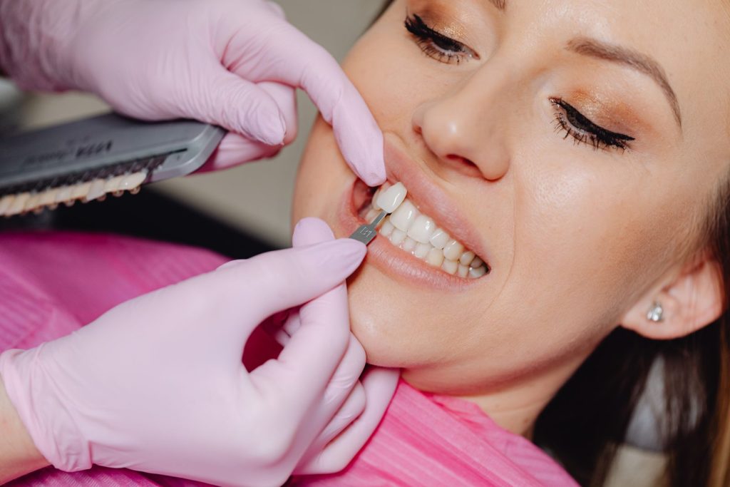 Emax Veneers Dubai