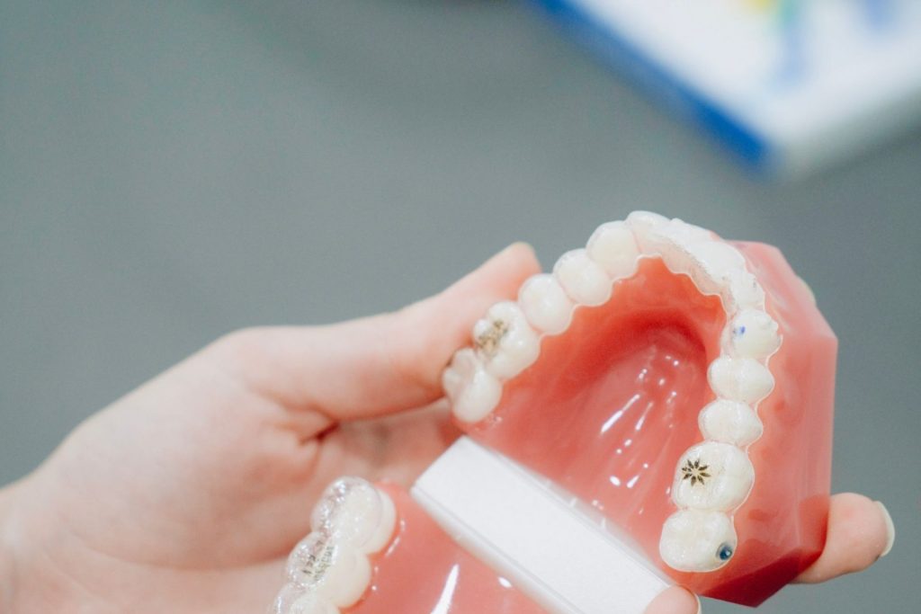 Orthodontic Treatments