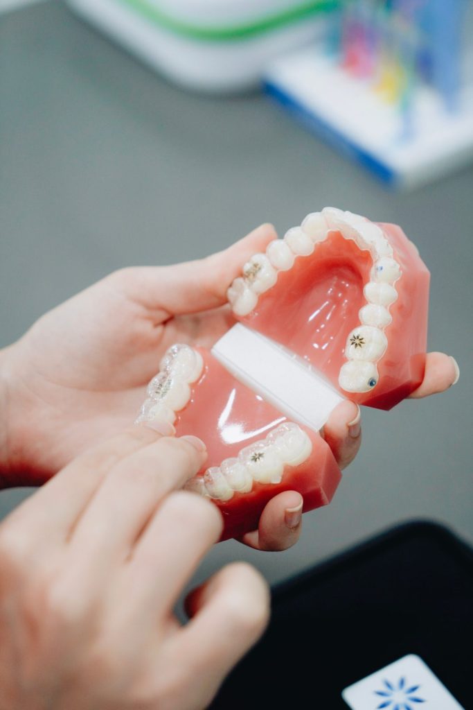 Orthodontic Treatments