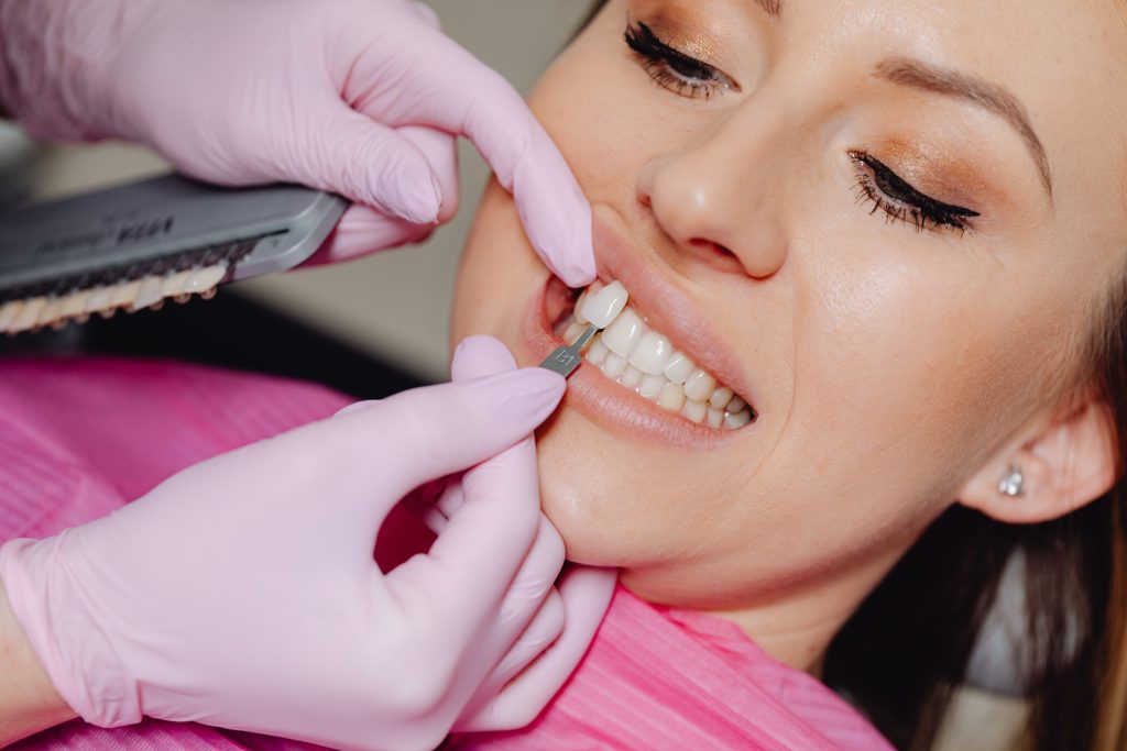 Veneers: A Smile Transformation Guide