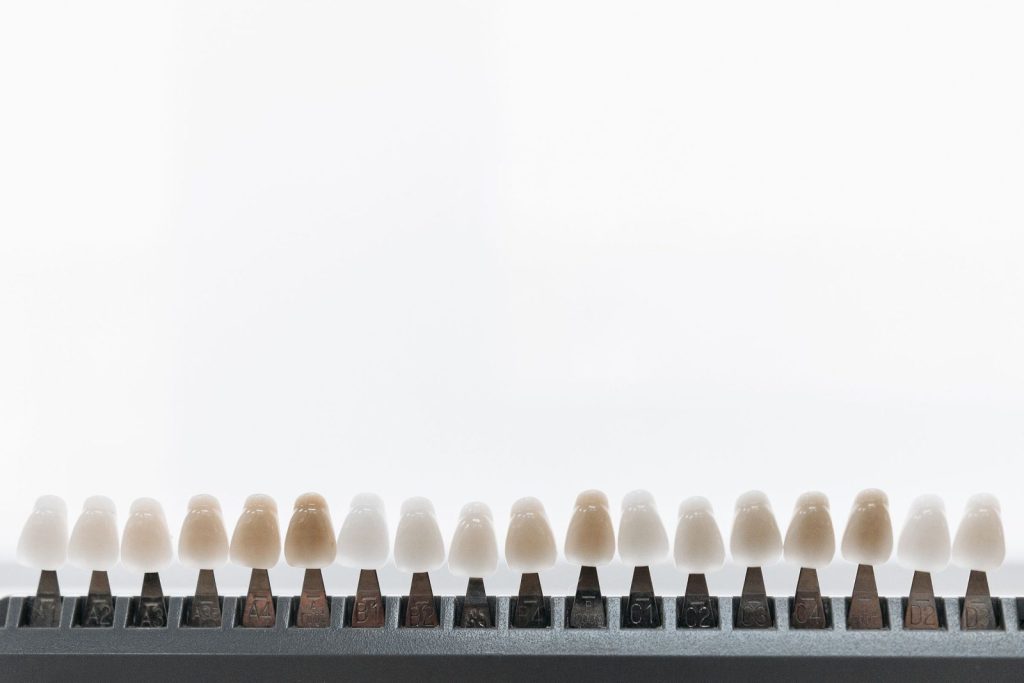 Dental veneer shade guide used for smile transformation