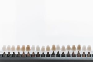 Dental veneer shade guide used for smile transformation