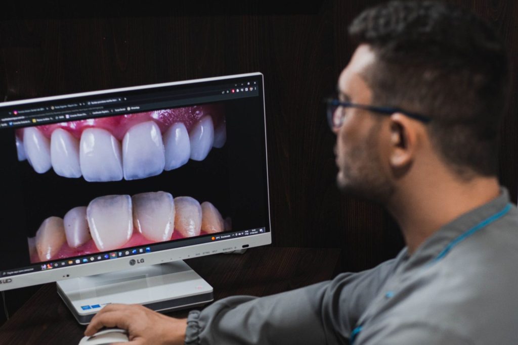 teeth whitening dubai