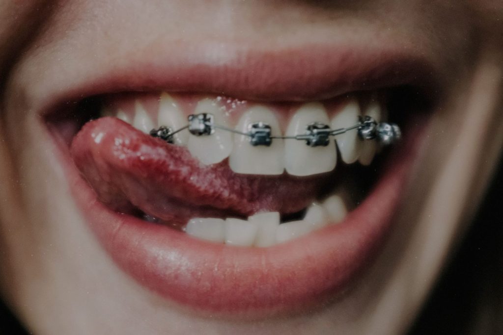 Orthodontist checking a patient's braces during orthodontic treatment