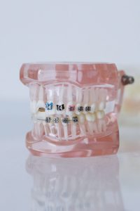 Orthodontist Dubai